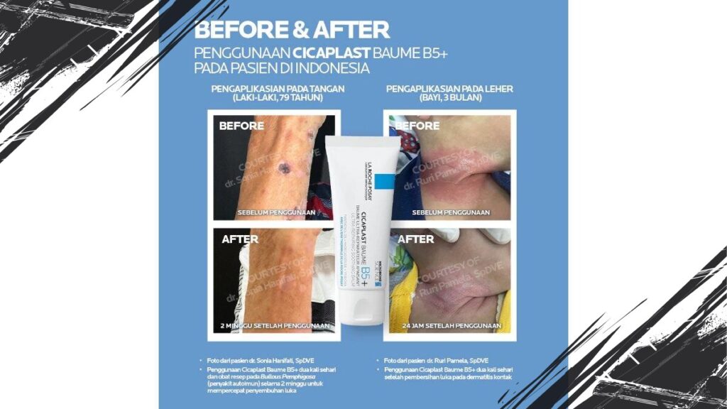 Complete Review of La Roche-Posay Cicaplast Baume B5+ Soothing Balm: Benefits, Pros, and Cons