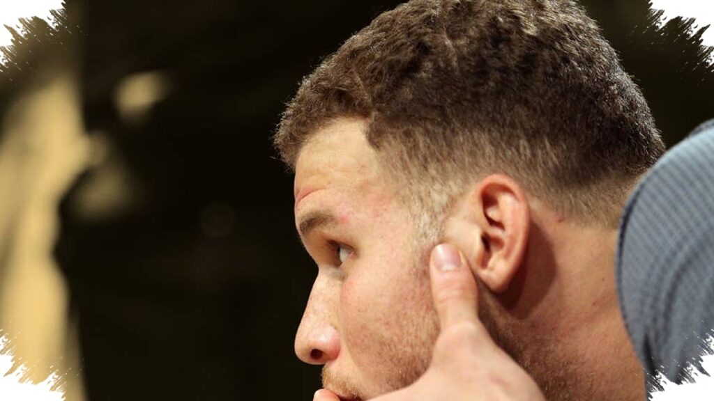 Blake Griffin’s Toronto Blowup Cost Him A Broken Hand And $860,000, We Had To Move On