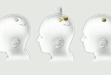 Samsung Moves Into Neuralink’s Brain Chip Race, A New Front Opens for Musk’s Ecosystem