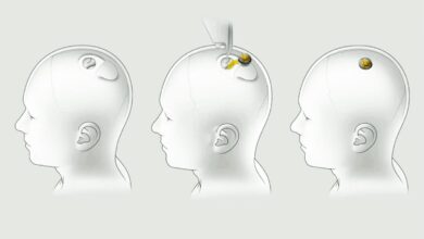 Samsung Moves Into Neuralink’s Brain Chip Race, A New Front Opens for Musk’s Ecosystem