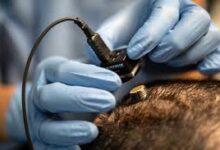 From MIT Engineer to Brain Surgeon, He Is Helping Restore Lost Communication